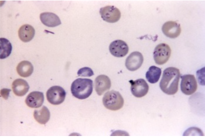 Babesia microorganism