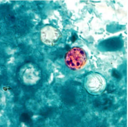 Microscope examining stool sample