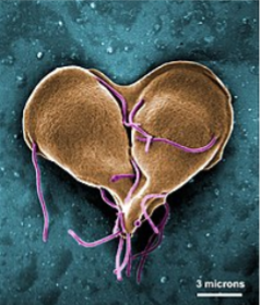 An electron microscope image of the giardia parasite